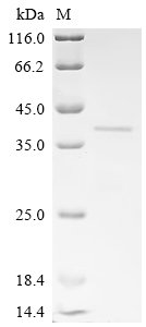 Recombinant Mouse Platelet endothelial aggregation receptor 1 (Pear1), partial, Mus musculus (Mouse), E.coli, N-terminal 6xHis-tagged, 32.9kDa, purity >95% as determined by SDS-PAGE.