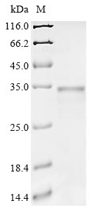 Recombinant Chromobacterium violaceum Phenylalanine-4-hydroxylase (phhA)