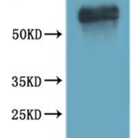 CSB-MP001181HU(F2) is detected by Mouse anti-6*His monoclonal antibody.