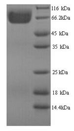 Recombinant Aspergillus niger 3-phytase A (phyA), Aspergillus niger, Yeast, N-terminal 6xHis-tagged, 50.8kDa, purity >90% as determined by SDS-PAGE.