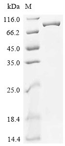 Recombinant Mouse Phosphatidylinositol 3-kinase regulatory subunit alpha (Pik3r1)