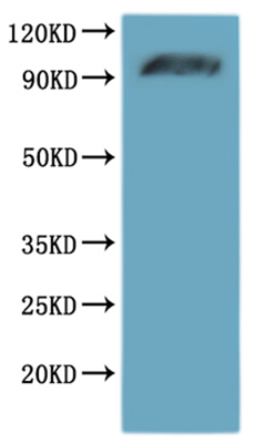 Recombinant Human Alpha-2A adrenergic receptor (ADRA2A)-VLPs Protein, Homo sapiens (Human), Mammalian cell, C-terminal 10xHis-tagged(This tag can be tested only under denaturing conditions), 52.0kDa, purity >95% as determined by SEC-HPLC.
