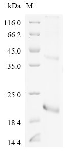 Recombinant Rat Phospholipase A2, membrane associated (Pla2g2a), Rattus norvegicus (Rat), E.coli, N-terminal 6xHis-tagged, 20.0kDa, purity >90% as determined by SDS-PAGE.