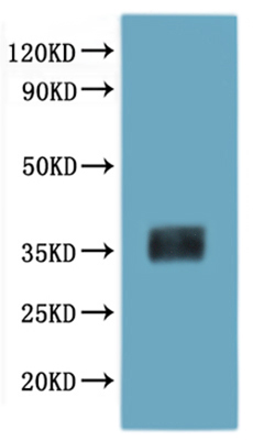 CSB-MP013558MO is detected by Mouse anti-6*His monoclonal antibody.