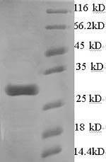 Recombinant Mouse Calcium-dependent phospholipase A2 (Pla2g5), Mus musculus (Mouse), E.coli, N-terminal 6xHis-SUMO-tagged, 29.8kDa, purity >90% as determined by SDS-PAGE.