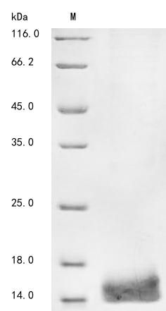 Recombinant Mouse Phospholipase A-2-activating protein (Plaa), partial, Mus musculus (Mouse), Baculovirus, N-terminal 10xHis-tagged and C-terminal Myc-tagged, 13.6kDa, purity >85% as determined by SDS-PAGE.