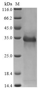 Recombinant Rat Urokinase plasminogen activator surface receptor (Plaur)