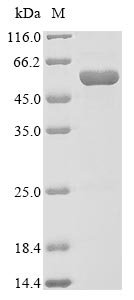 Recombinant Streptococcus pneumoniae serotype 4 Pneumolysin (ply)