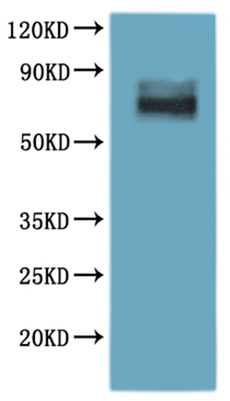 Recombinant Human umor necrosis factor receptor superfamily member 16 (NGFR),Biotinylated-VLPs Protein, Homo sapiens (Human), Mammalian cell, N-terminal 6xHis-Avi-tagged(This tag can be tested only under denaturing conditions), 46.5kDa