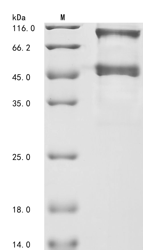 Recombinant Neosartorya fumigata Probable pectate lyase C (plyC), Neosartorya fumigata (strain CEA10 / CBS 144.89 / FGSC A1163) (Aspergillus fumigatus), Mammalian cell, C-terminal 6xHis-tagged, 44.3kDa, purity >85% as determined by SDS-PAGE.
