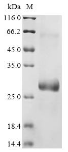 Recombinant Mouse Protein PML (Pml), partial, Mus musculus (Mouse), E.coli, N-terminal 10xHis-tagged and C-terminal Myc-tagged, 28.1kDa, purity >85% as determined by SDS-PAGE.