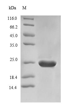 Recombinant Saccharomyces cerevisiae Nicotinamidase (PNC1), Saccharomyces cerevisiae (strain ATCC 204508 / S288c) (Baker's yeast), E.coli, Tag-Free, 25.0kDa, purity >90% as determined by SDS-PAGE.