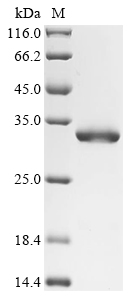 Recombinant Escherichia coli nicotinamidase (pncA)