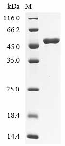 Recombinant Bovine Paraneoplastic antigen Ma2 homolog (PNMA2)