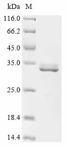 Recombinant Rat Purine nucleoside phosphorylase (Pnp)