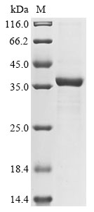 Recombinant Bovine Palmitoyl-protein thioesterase 1 (PPT1)