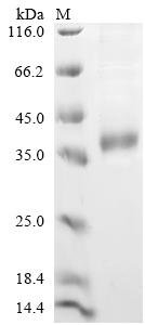 Recombinant Mouse Palmitoyl-protein thioesterase 1 (Ppt1), Mus musculus (Mouse), Mammalian cell, C-terminal 10xHis-tagged, 33.0kDa, purity >90% as determined by SDS-PAGE.