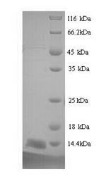 Recombinant Mouse Prostate stem cell antigen (Psca), Mus musculus (Mouse), Yeast, N-terminal 6xHis-tagged, 10.4kDa, purity >90% as determined by SDS-PAGE.