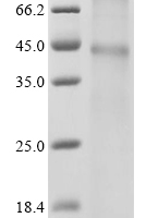 (Tris-Glycine gel) Discontinuous SDS-PAGE (reduced) with 5% enrichment gel and 15% separation gel.