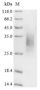 Recombinant Macaca fascicularis Parathyroid hormone/parathyroid hormone-related peptide receptor (PTH1R), partial, Macaca fascicularis (Crab-eating macaque) (Cynomolgus monkey), Mammalian cell, C-terminal 10xHis-tagged, 22.2kDa, purity >90% as determined by SDS-PAGE.