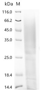 Recombinant Pig Parathyroid hormone/parathyroid hormone-related peptide receptor (PTH1R), partial, Sus scrofa (Pig), Yeast, C-terminal 6xHis-tagged, 19.6kDa, purity >90% as determined by SDS-PAGE.