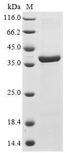 Recombinant Mouse Receptor-type tyrosine-protein phosphatase S (Ptprs), partial, Mus musculus (Mouse), E.coli, N-terminal 10xHis-tagged and C-terminal Myc-tagged, 39.2kDa, purity >85% as determined by SDS-PAGE.