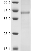 (Tris-Glycine gel) Discontinuous SDS-PAGE (reduced) with 5% enrichment gel and 15% separation gel.