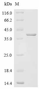 Recombinant Bordetella pertussis Pertussis toxin subunit 1 (ptxA), Bordetella pertussis (strain Tohama I / ATCC BAA-589 / NCTC 13251), E.coli, N-terminal 6xHis-B2M-tagged, 40.8kDa, purity >85% as determined by SDS-PAGE.