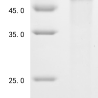 (Tris-Glycine gel) Discontinuous SDS-PAGE (reduced) with 5% enrichment gel and 15% separation gel.