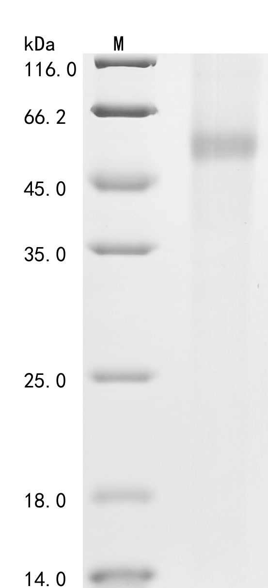 Recombinant Human Muscle, skeletal receptor tyrosine-protein kinase (MUSK), partial Protein, Homo sapiens (Human), in vitro E.coli expression system, N-terminal 10xHis-tagged, 54.0kDa, purity >90% as determined by SDS-PAGE.