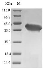Recombinant Laribacter hongkongensis Orotate phosphoribosyltransferase (pyrE)