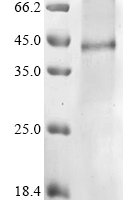 (Tris-Glycine gel) Discontinuous SDS-PAGE (reduced) with 5% enrichment gel and 15% separation gel.
