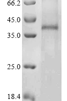 (Tris-Glycine gel) Discontinuous SDS-PAGE (reduced) with 5% enrichment gel and 15% separation gel.
