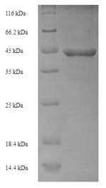 Recombinant Escherichia coli DNA repair protein recO (recO)