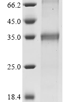 (Tris-Glycine gel) Discontinuous SDS-PAGE (reduced) with 5% enrichment gel and 15% separation gel.
