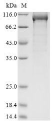 Recombinant Severe acute respiratory syndrome coronavirus 2 Replicase polyprotein 1ab (rep) (P4714L), partial