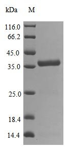 Recombinant Severe acute respiratory syndrome coronavirus 2 Replicase polyprotein 1ab (rep), partial, Severe acute respiratory syndrome coronavirus 2 (2019-nCoV) (SARS-CoV-2), E.coli, N-terminal 10xHis-tagged, 39.8kDa, purity >85% as determined by SDS-PAGE.