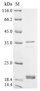 Recombinant Human immunodeficiency virus 1 Protein Rev (rev) (P93S,X94V)