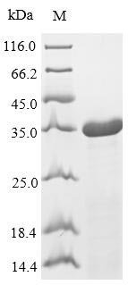 Recombinant Streptococcus pyogenes serotype M6 50S ribosomal protein L7/L12 (rplL)