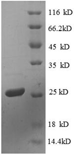 Recombinant Escherichia coli 30S ribosomal protein S4 (rpsD)