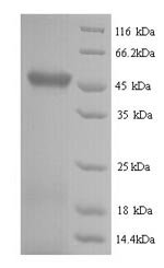Recombinant Escherichia coli RNA-splicing ligase RtcB (rtcB)