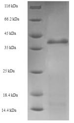 Recombinant Escherichia coli Holliday junction ATP-dependent DNA helicase RuvA (ruvA)
