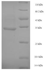 Recombinant Escherichia coli Crossover junction endodeoxyribonuclease RuvC (ruvC), Escherichia coli (strain K12), E.coli, N-terminal 6xHis-SUMO-tagged, 34.6kDa, purity >90% as determined by SDS-PAGE.