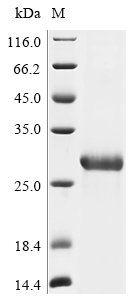 Recombinant Bat coronavirus HKU9 Spike glycoprotein (S), partial, Bat coronavirus HKU9 (BtCoV) (BtCoV/HKU9), E.coli, N-terminal 6xHis-tagged, 27.6kDa, purity >90% as determined by SDS-PAGE.