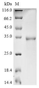 Recombinant Bat coronavirus 133/2005 Spike glycoprotein (S), partial