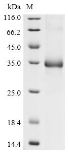 Recombinant Human coronavirus HKU1 Spike glycoprotein (S), partial, Human coronavirus HKU1 (isolate N2) (HCoV-HKU1), E.coli, C-terminal 6xHis-tagged, 35.7kDa, purity >90% as determined by SDS-PAGE.