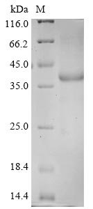 Recombinant Human coronavirus HKU1 Spike glycoprotein (S), partial, Human coronavirus HKU1 (isolate N1) (HCoV-HKU1), E.coli, C-terminal 6xHis-tagged, 42.3kDa, purity >85% as determined by SDS-PAGE.