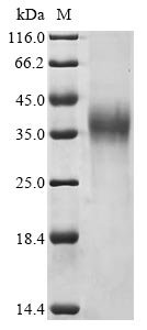 Recombinant Avian infectious bronchitis virus Spike glycoprotein (S), partial, Avian infectious bronchitis virus (strain UK/123/82) (IBV), Mammalian cell, C-terminal 6xHis-tagged, 27kDa, purity >90% as determined by SDS-PAGE.
