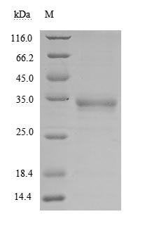 Recombinant Severe acute respiratory syndrome coronavirus 2 Spike glycoprotein (S) (V367F), partial (Active), Severe acute respiratory syndrome coronavirus 2 (2019-nCoV) (SARS-CoV-2), Mammalian cell, C-terminal 10xHis-tagged, 27.9kDa, purity >90% as determined by SDS-PAGE.