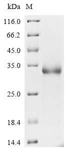 Recombinant Severe acute respiratory syndrome coronavirus 2 Spike glycoprotein (S) (K417N,E484K,N501Y), partial